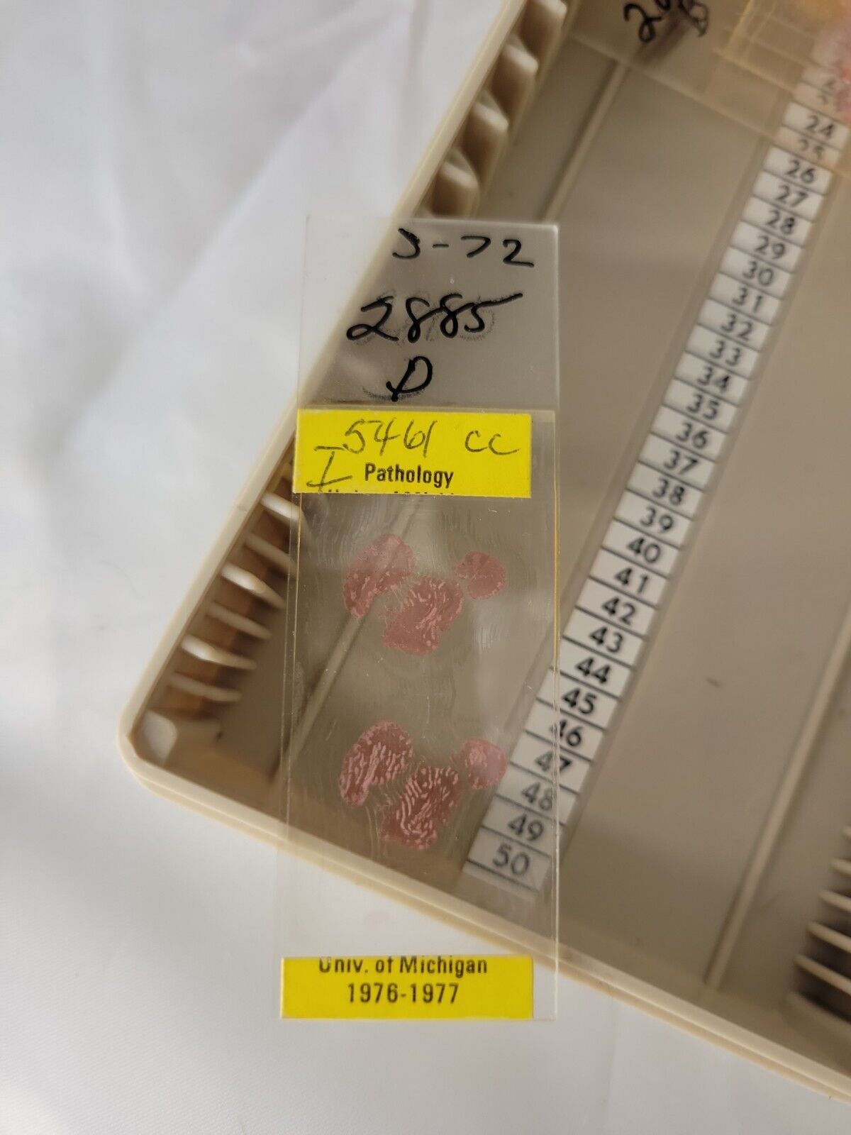 1976-77 Pathology Neoplasm University of Michigan Microscope Slides
