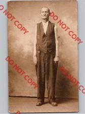 WOW c1910 Circus Sideshow Freak SKINNY ARMS Weird Body Unusual RPPC Real Photo picture