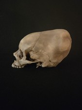 Realistic Elongated Human Skull Replica - Life Size picture