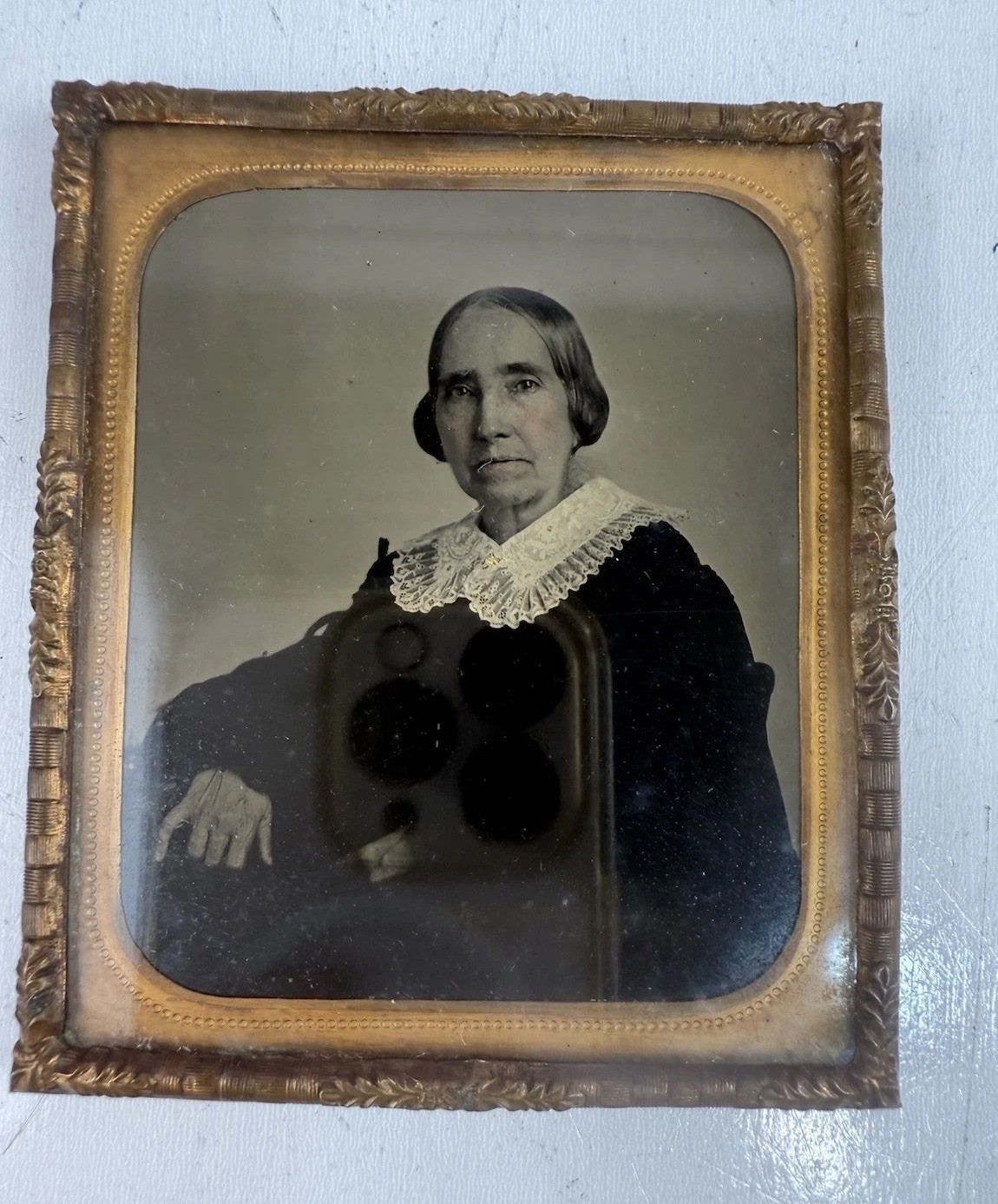 Antique 1850’s Ambrotype Photo Women Lace Collar Severe Arthritis Medical 1/6 ..