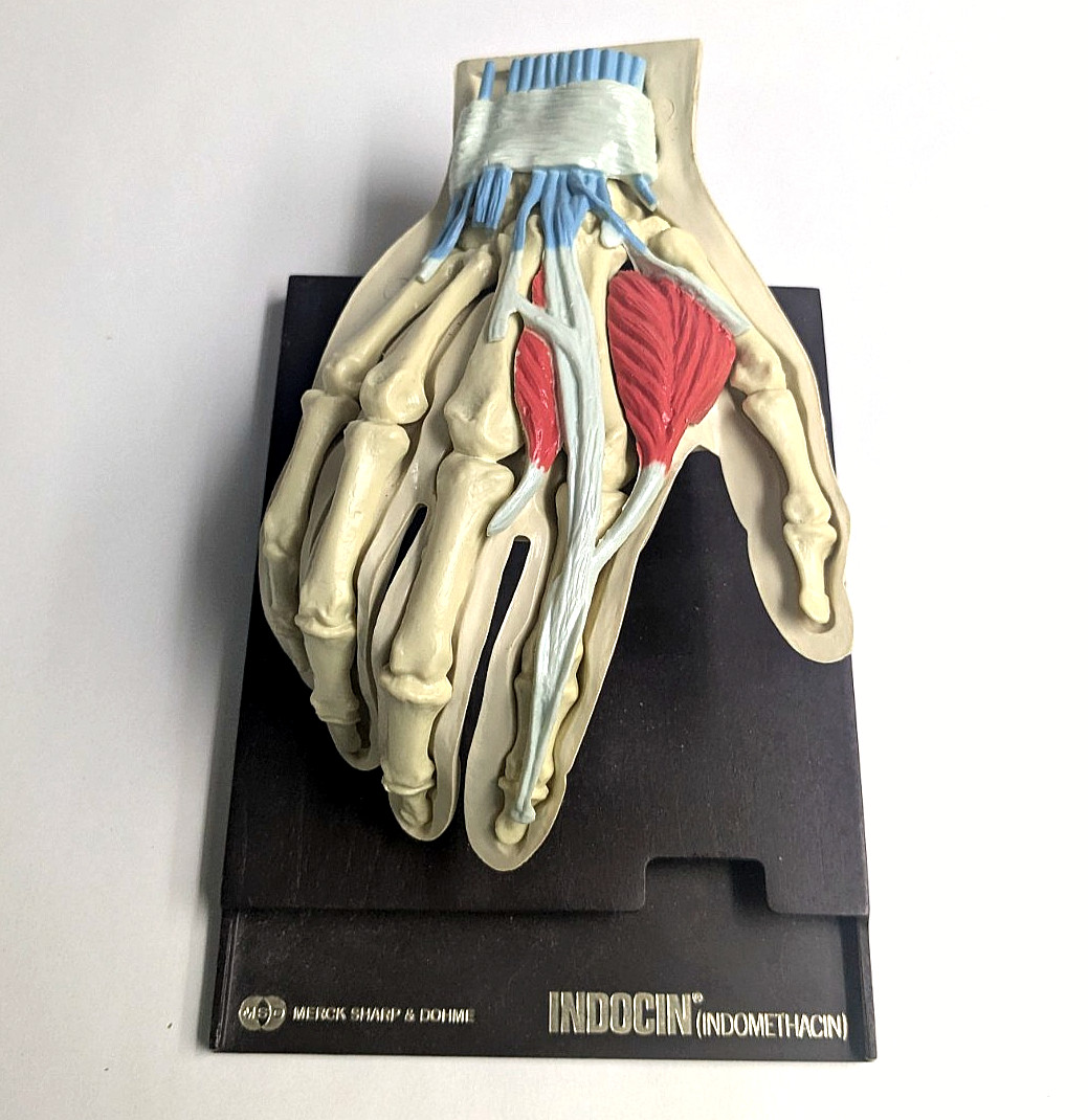 Vintage 1960s Merck Indocin Anatomical Hand Model Medical Advertising Display