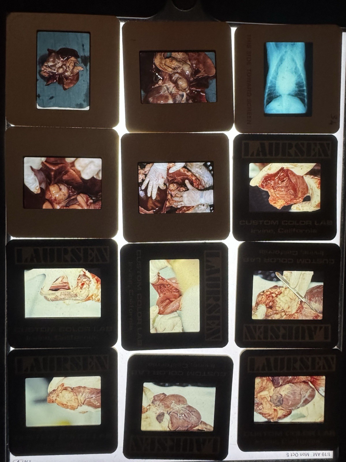 Vintage 1980s Medical Slide Film Lot ~500 slide photographs + Carousels