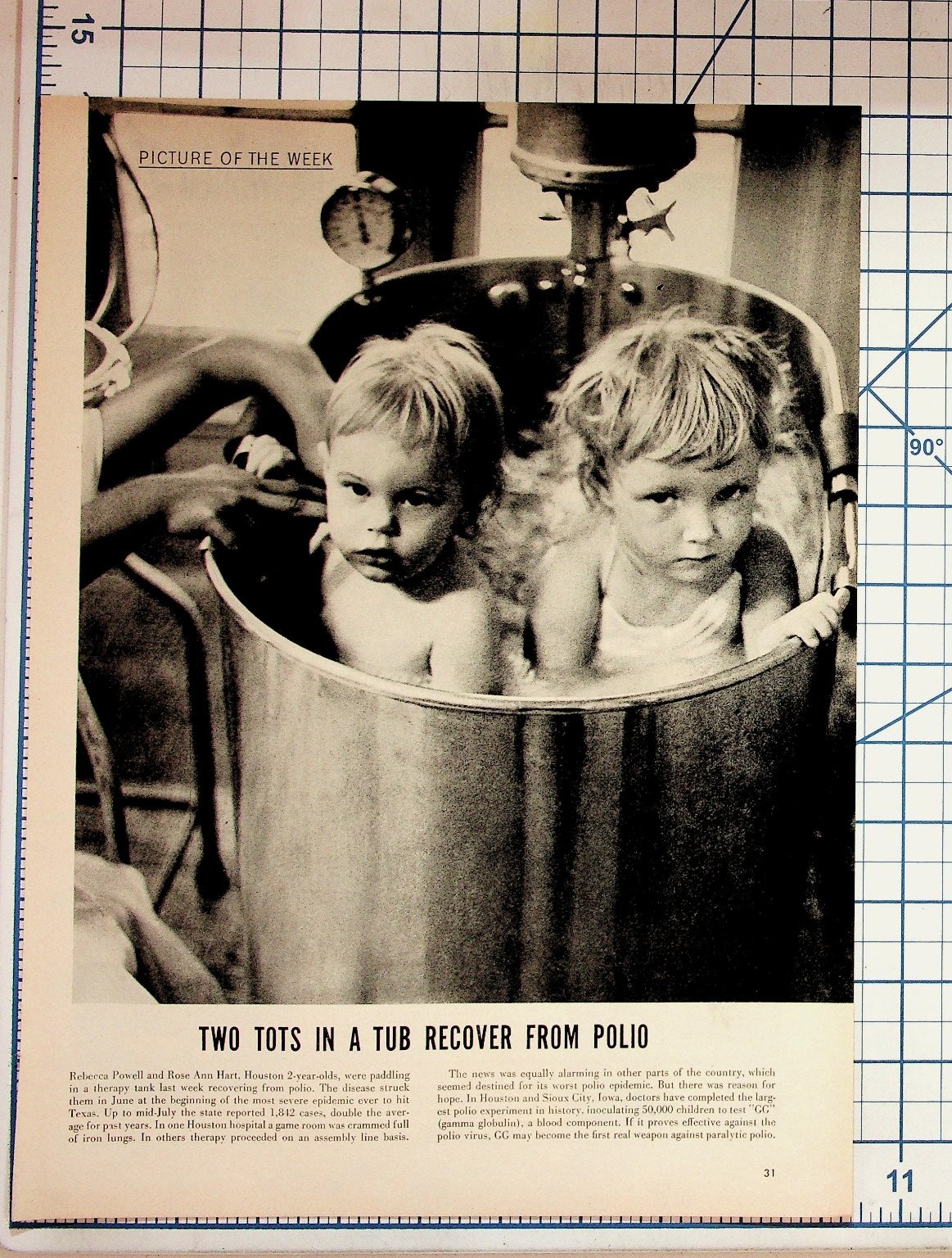 1950s Polio Epidemic News Magazine Page Two Tots in Tub Recovery Photo
