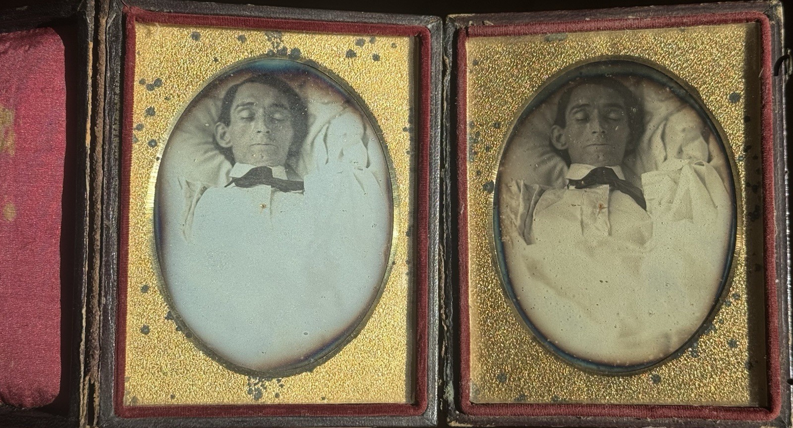 Rare Set Of (2) Post Mortem Daguerreotypes Same Person Man 1/4 Plates Close Up